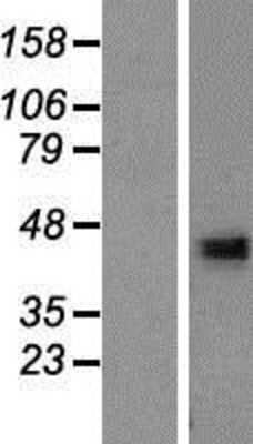 Western Blot: DHRS13 Overexpression Lysate [NBP2-05548]