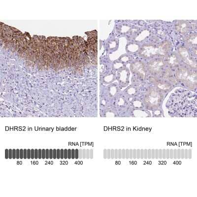 Immunohistochemistry-Paraffin: DHRS2 Antibody [NBP2-49605]