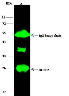 Immunoprecipitation: DHRS2 Antibody [NBP3-12781]