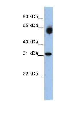 Western Blot: DHRS2 Antibody [NBP1-54922]