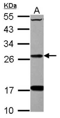 Western Blot: DHRS2 Antibody [NBP2-16159]