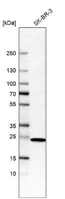 Western Blot: DHRS2 Antibody [NBP2-56196]