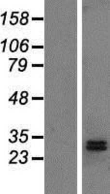 Western Blot: DHRS2 Overexpression Lysate [NBP2-04800]