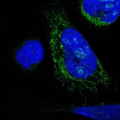Immunocytochemistry/ Immunofluorescence: DHRS3 Antibody [NBP1-80846]