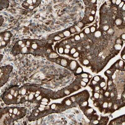 Immunohistochemistry-Paraffin: DHRS3 Antibody [NBP1-80846]
