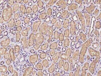 Immunohistochemistry-Paraffin: DHRS3 Antibody [NBP3-06444]