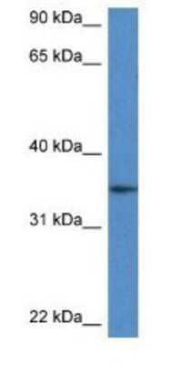 Western Blot: DHRS3 Antibody [NBP1-79192]