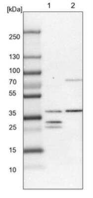 Western Blot: DHRS3 Antibody [NBP1-80846]