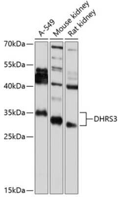 Western Blot: DHRS3 AntibodyBSA Free [NBP2-92496]