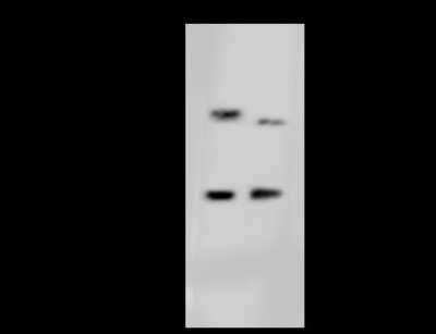 Western Blot: DHRS3 Antibody [NBP2-99196]