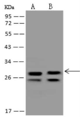 Western Blot: DHRS3 Antibody [NBP3-06444]