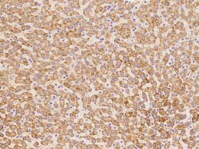 Immunohistochemistry-Paraffin: DHRS4 Antibody [NBP2-98675]