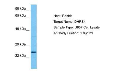 Western Blot: DHRS4 Antibody [NBP2-84787]