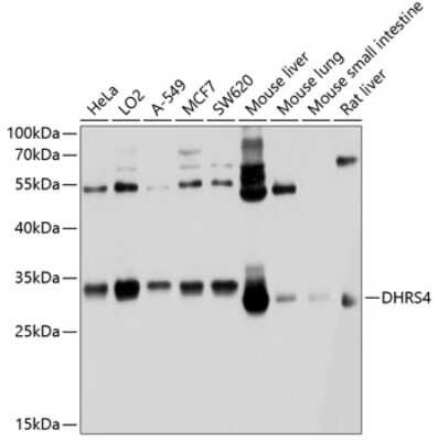 Western Blot: DHRS4 AntibodyBSA Free [NBP2-92009]