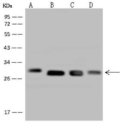 Western Blot: DHRS4 Antibody [NBP2-98675]
