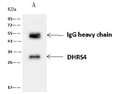 Western Blot: DHRS4 Antibody [NBP2-98675]