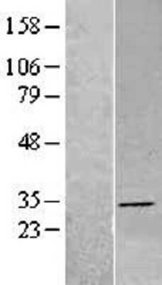 Western Blot: DHRS4 Overexpression Lysate [NBL1-09869]