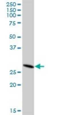 Western Blot: DHRS4L2 Antibody [H00317749-B01P]