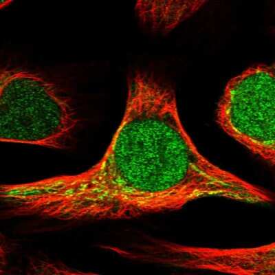 Immunocytochemistry/ Immunofluorescence: DHRS7 Antibody [NBP1-80842]
