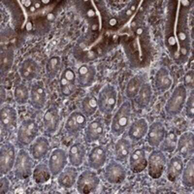 Immunohistochemistry-Paraffin: DHRS7 Antibody [NBP3-17357]