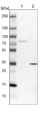 Western Blot: DHRS7 Antibody [NBP1-80842]