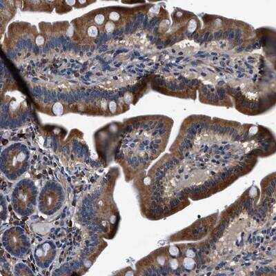 Immunohistochemistry-Paraffin: DHRS7B Antibody [NBP1-85648]
