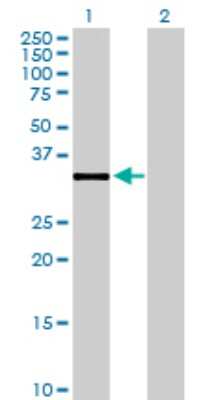 Western Blot: DHRS7B Antibody [H00025979-B01P]