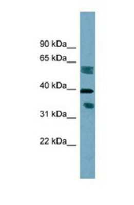 Western Blot: DHRS7B Antibody [NBP1-69584]