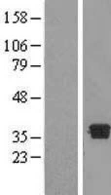 Western Blot: DHRS7B Overexpression Lysate [NBL1-09872]