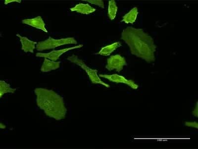 Immunocytochemistry/ Immunofluorescence: DHRS9 Antibody (3C6) [H00010170-M05]