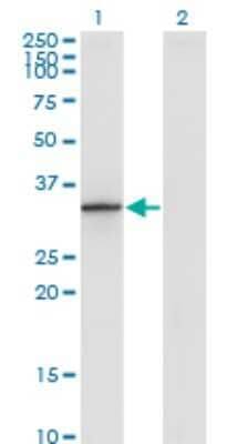 Western Blot: DHRS9 Antibody (3E3) [H00010170-M06]