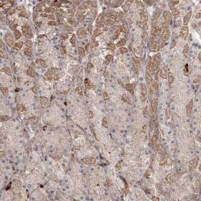 Immunohistochemistry-Paraffin: DHRS9 Antibody [NBP1-89378]