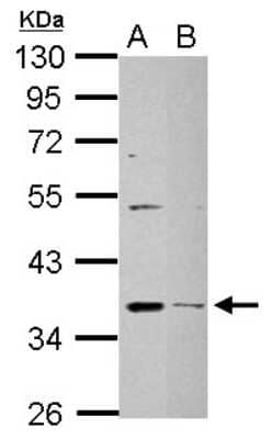 Western Blot: DHRS9 Antibody [NBP2-16160]