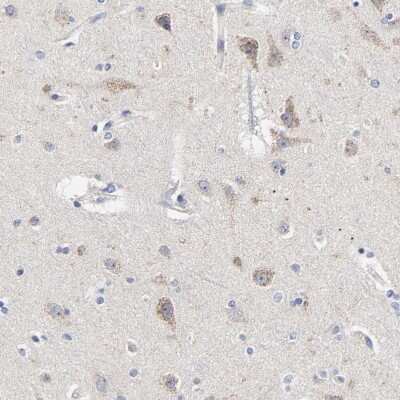 Immunohistochemistry-Paraffin: DHRSX Antibody [NBP1-85219]