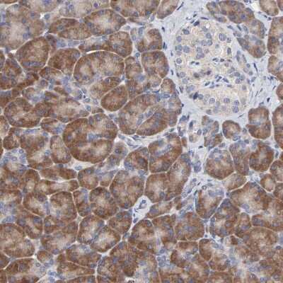 Immunohistochemistry-Paraffin: DHRSX Antibody [NBP1-85219]