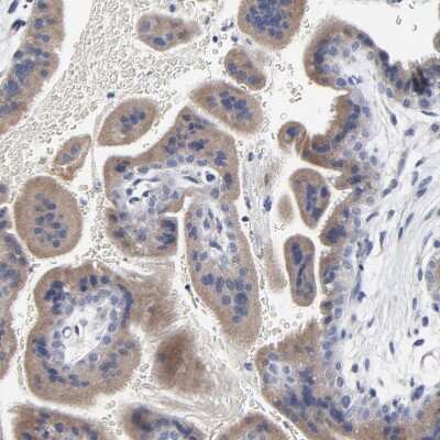 Immunohistochemistry-Paraffin: DHRSX Antibody [NBP1-85219]
