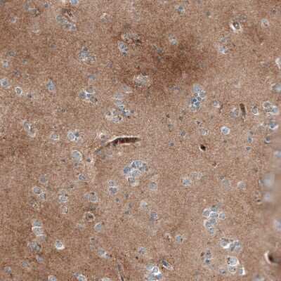 Immunohistochemistry-Paraffin: DHRSX Antibody [NBP1-85219]