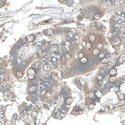 Immunohistochemistry-Paraffin: DHRSX Antibody [NBP1-85219]