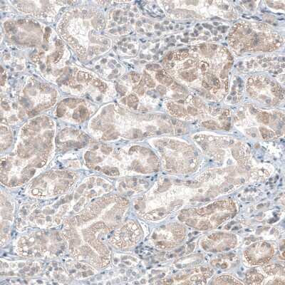 Immunohistochemistry-Paraffin: DHRSX Antibody [NBP1-85219]