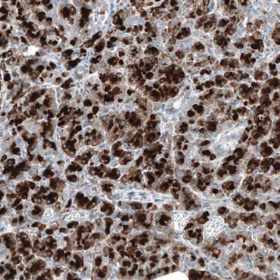 Immunohistochemistry-Paraffin: DHRSX Antibody [NBP1-85219]