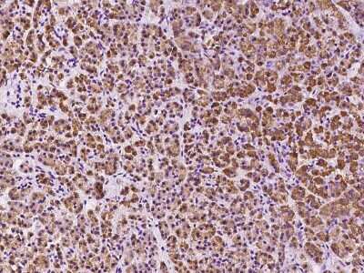 Immunohistochemistry-Paraffin: DHRSX Antibody [NBP2-97560]