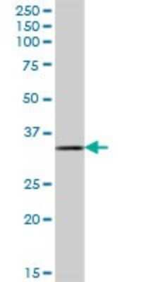 Western Blot: DHRSX Antibody [H00207063-B01P]