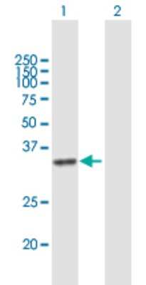 Western Blot: DHRSX Antibody [H00207063-B01P]