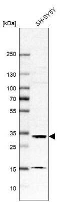 Western Blot: DHRSX Antibody [NBP1-85219]