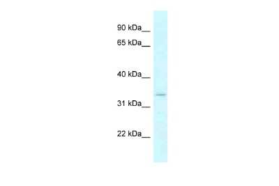 Western Blot: DHRSX Antibody [NBP2-87269]