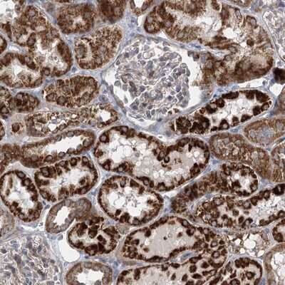 Immunohistochemistry-Paraffin: DHTKD1 Antibody [NBP1-84087]
