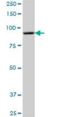 Western Blot: DHTKD1 Antibody [H00055526-B01P]