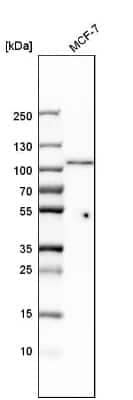 Western Blot: DHTKD1 Antibody [NBP1-84087]