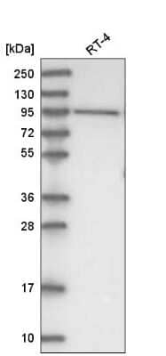 Western Blot: DHTKD1 Antibody [NBP2-55215]