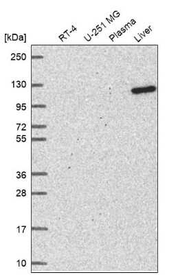 Western Blot: DHTKD1 Antibody [NBP2-57835]